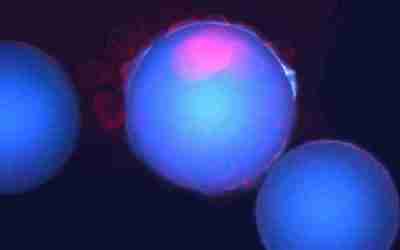 Stress and Breast Cancer Stem Cells